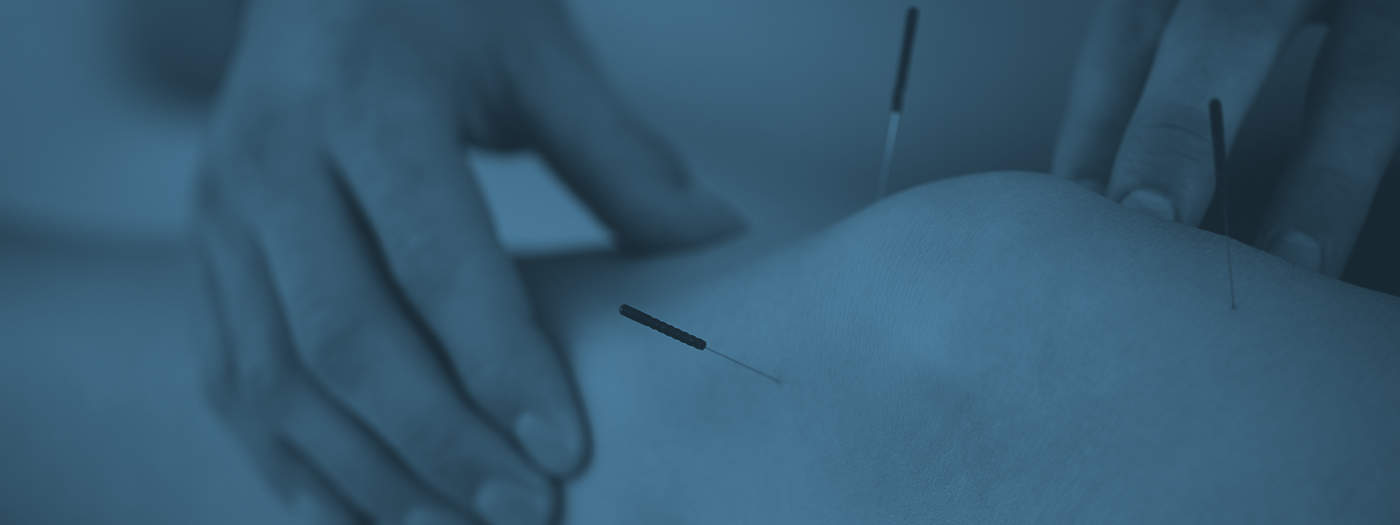 Acupuncture Clinics Guelph, Guelph Acupuncture